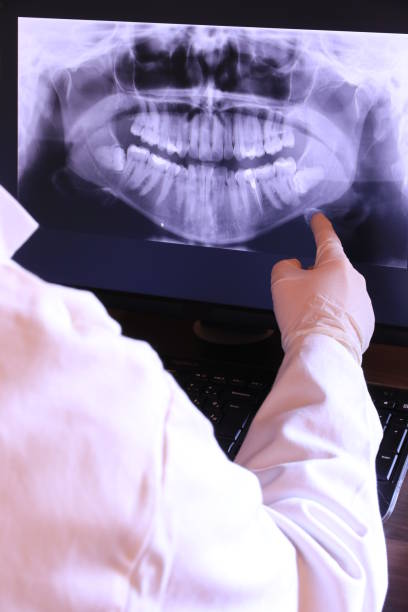 Best Emergency Tooth Extraction in Navarre, OH