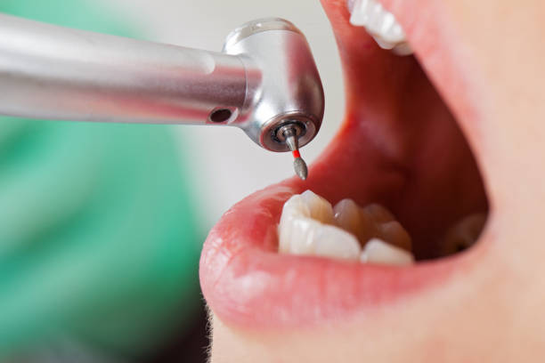 Best Walk-In Emergency Dentist in Navarre, OH